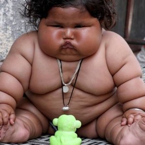 Obesidade infantil: causas e consequências